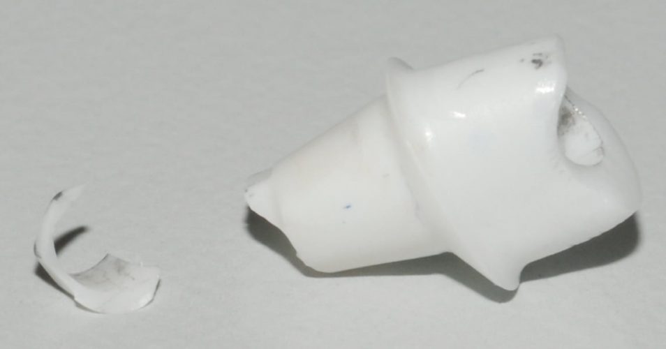 Ryc. 93–97. Pęknięcie łącznika wewnątrz implantu. Odłam usunięto bez szkody dla powierzchni interfejsu.
